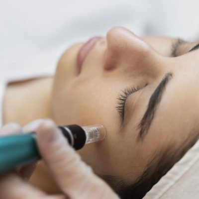 person-getting-micro-needling-beauty-treatment.jpg